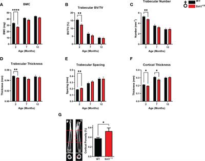 SIRT1 haplo-insufficiency results in reduced cortical bone thickness, increased porosity and decreased estrogen receptor alpha in bone in adult 129/Sv female mice